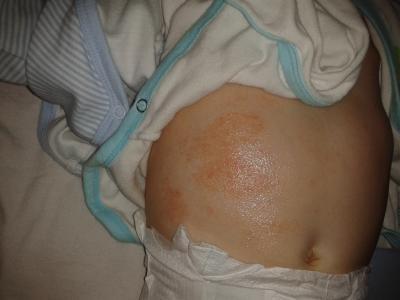 Bild zu könnt ihr mir einen tipp geben:-( - Babypflege - so pflegen Sie Ihr Baby richtig