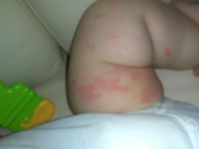 Bild zu was kann das sein? (Bild hinzugefügt) - Babypflege - so pflegen Sie Ihr Baby richtig