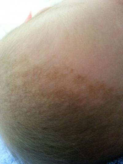 Bild zu Milchschorf, Gneis oder etwas ganz anderes? - Babypflege - so pflegen Sie Ihr Baby richtig