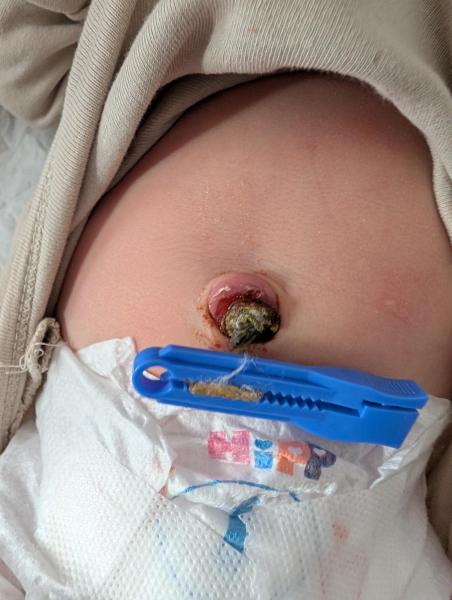 Bild zu Bauchnabel Blut - Babypflege - so pflegen Sie Ihr Baby richtig
