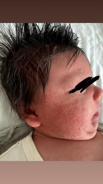 Bild zu trockene haut - Babypflege - so pflegen Sie Ihr Baby richtig