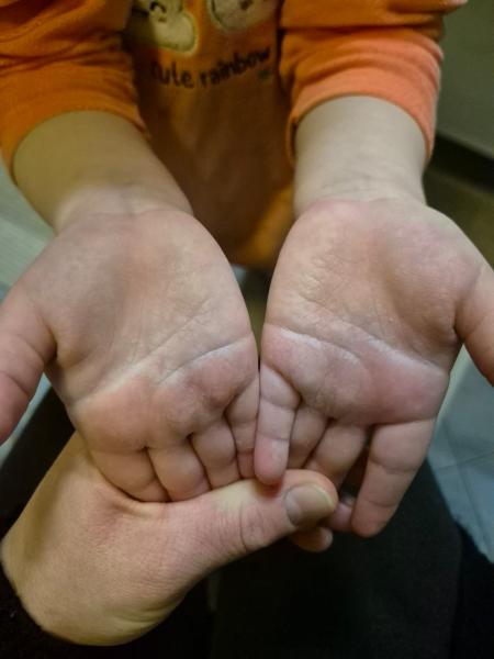 Bild zu Zu viel Hände waschen ? - Babypflege - so pflegen Sie Ihr Baby richtig