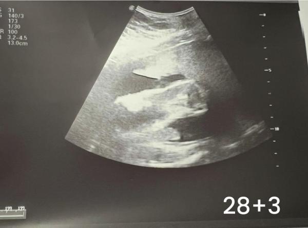 Bild zu Baby Geschlecht? - Elternforum rund um die Erziehung