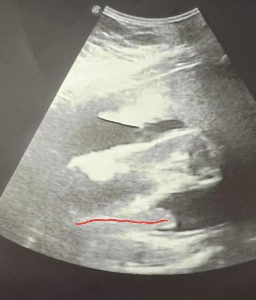 Bild zu Baby Geschlecht? - Elternforum rund um die Erziehung