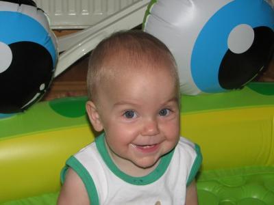 Bild zu Mal ein Bild von EMILIA *12.09.2012 (in der 32ssw geboren) ! - Hilfe für chronisch kranke und behinderte Kinder
