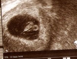 Bild zu Ein lieber Gruß... - Forum und Treffpunkt für Omas