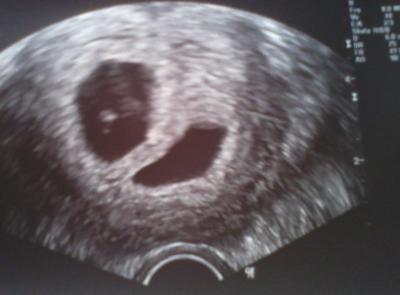 Bild zu Ich werde auch wieder Oma - Forum und Treffpunkt für Omas