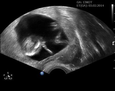 Bild zu Hin und weg - Forum und Treffpunkt für Omas