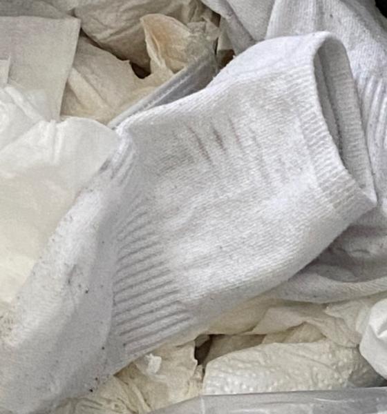 Bild zu Schimmel an Kleidung/Socke - Mein Haushalt