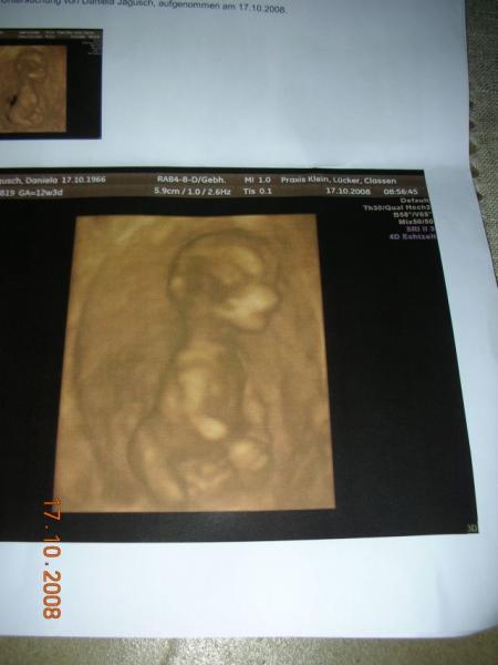 Bild zu US-Fotos von uns - Schwanger mit 35 plus - Forum