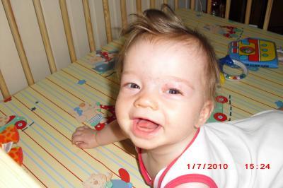 Bild zu