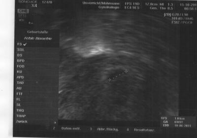 Bild zu Zurück vom FA  Termin - Schwanger mit 35 plus - Forum