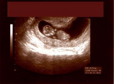 Bild zu Mein Baby!!! - Schwanger mit 35 plus - Forum