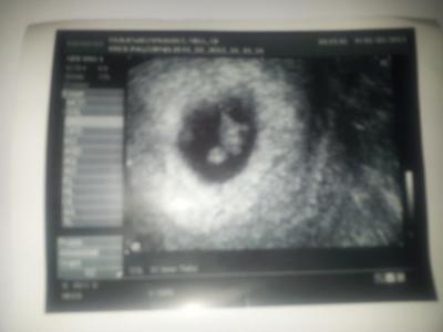 Bild zu Doctermin beendet .................... - Schwanger mit 35 plus - Forum