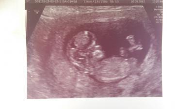 Bild zu Bin wieder dabei.:)) - Schwanger mit 35 plus - Forum