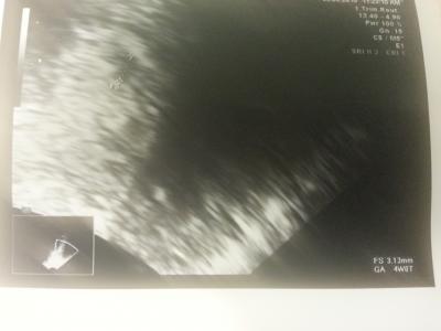 Bild zu Mini..... - Schwanger mit 35 plus - Forum