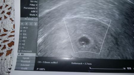 Bild zu ssw - Schwanger mit 35 plus - Forum