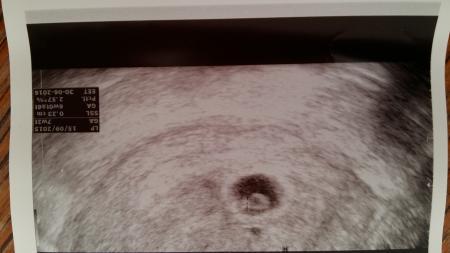 Bild zu ssw - Schwanger mit 35 plus - Forum