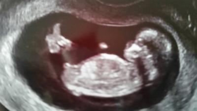 Bild zu Nub-Theorie - welches Geschlecht sehr ihr?? - Schwanger mit 35 plus - Forum