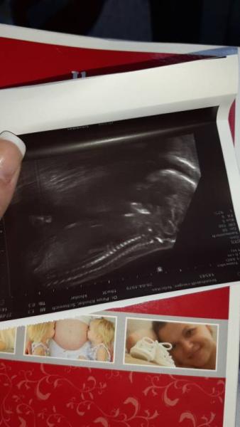 Bild zu Wieder mal eine Vorsorge überstanden - Schwanger mit 35 plus - Forum