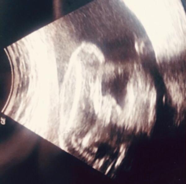 Bild zu Tatsächlich Junge? - Schwanger mit 35 plus - Forum