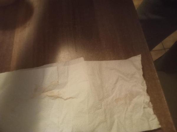 Bild zu Einnistungsblutung? - Schwanger mit 35 plus - Forum