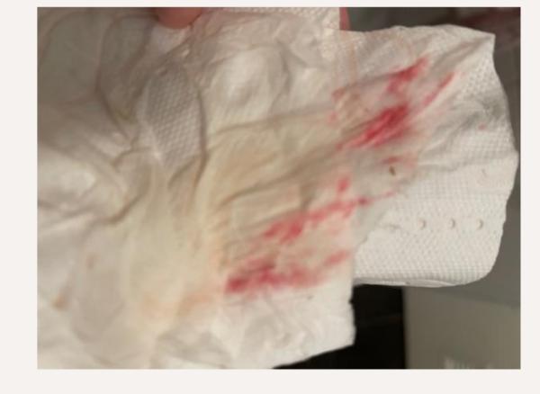 Bild zu Einnistungsblutung? - Schwanger mit 35 plus - Forum