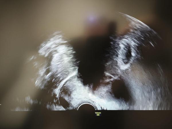 Bild zu Etwas Enttäuscht vom ersten Ultraschall - Schwanger mit 35 plus - Forum