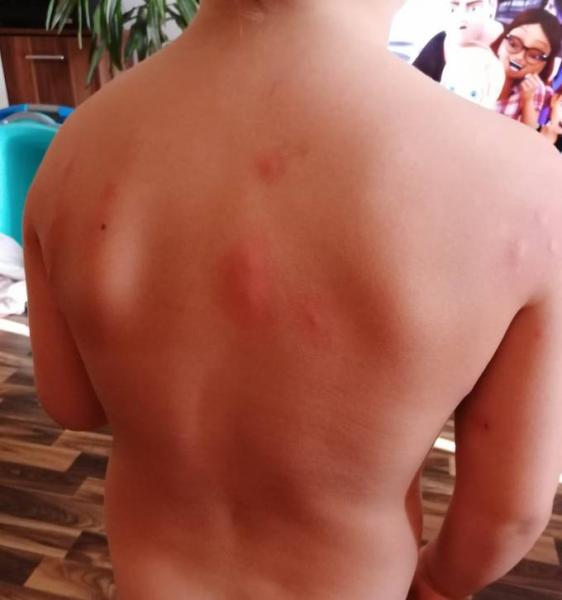 Bild zu Kindergartenleiterin verweigert Anruf Notarzt - Kigakids