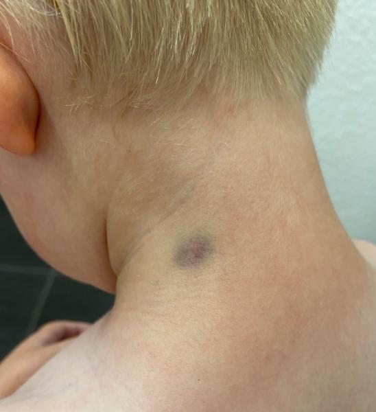 Bild zu Komischer blauer Fleck - Kigakids