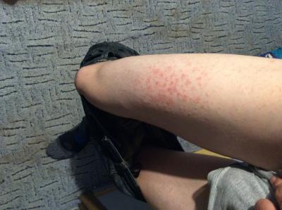 Bild zu Erfahrung mit reisekrankenversicherung gemacht:-( - Reisen, Reiseforum, Urlaub mit Kinder