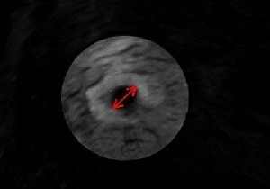 Ultraschall in der Frühschwangerschaft