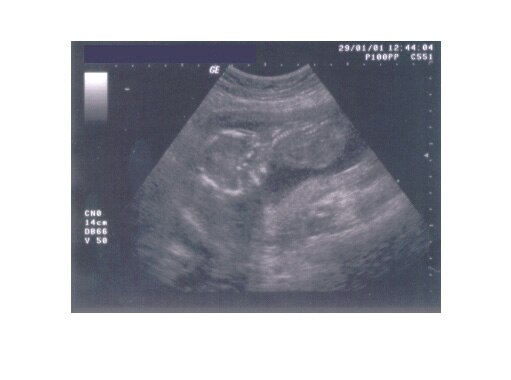 ultraschall-woche-16