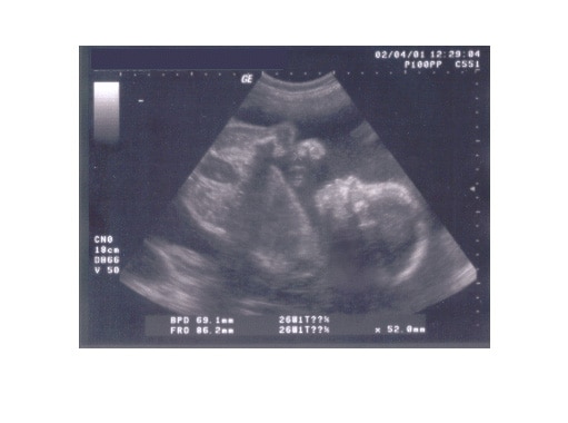 ultraschall-woche-24