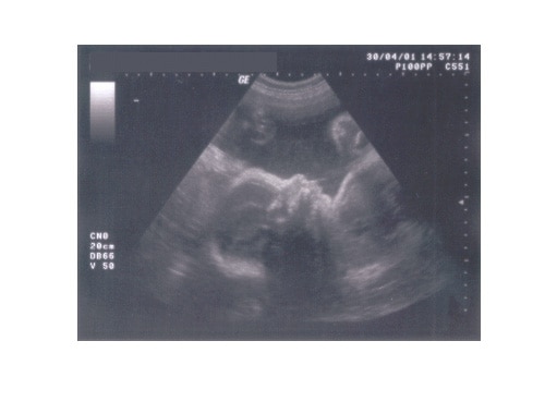 ultraschall-woche-28