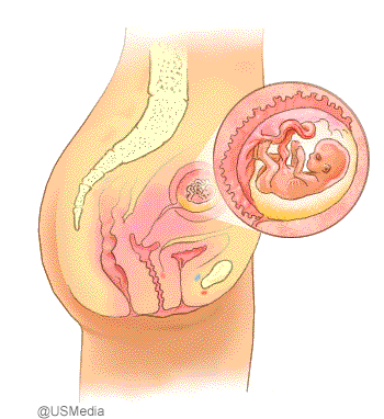 3.monat
