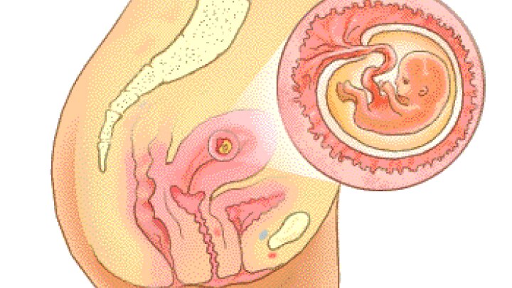 2.monat