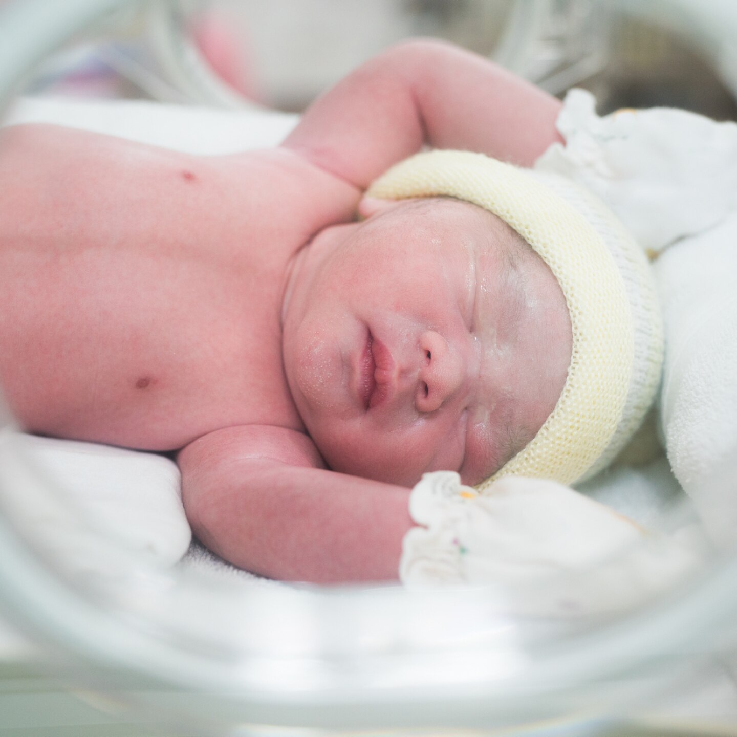 frühgeburt in babyschale