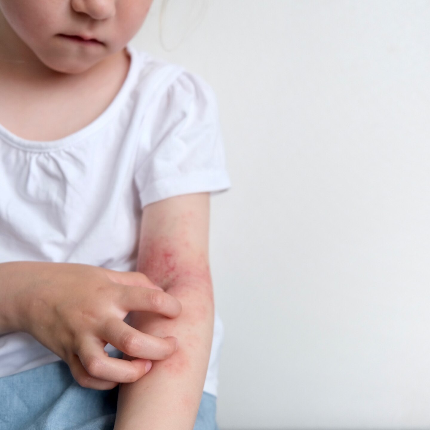 maedchen mit juckreiz am arm