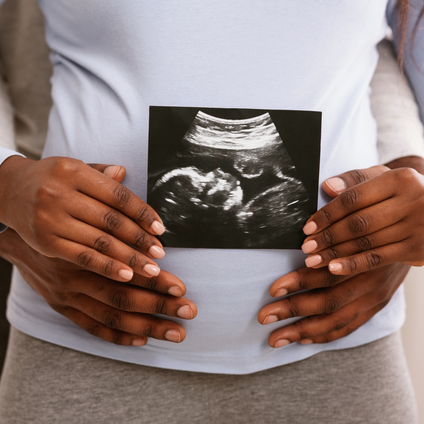 schwangere-hält-ultraschall-bild-vor-ihren-bauch