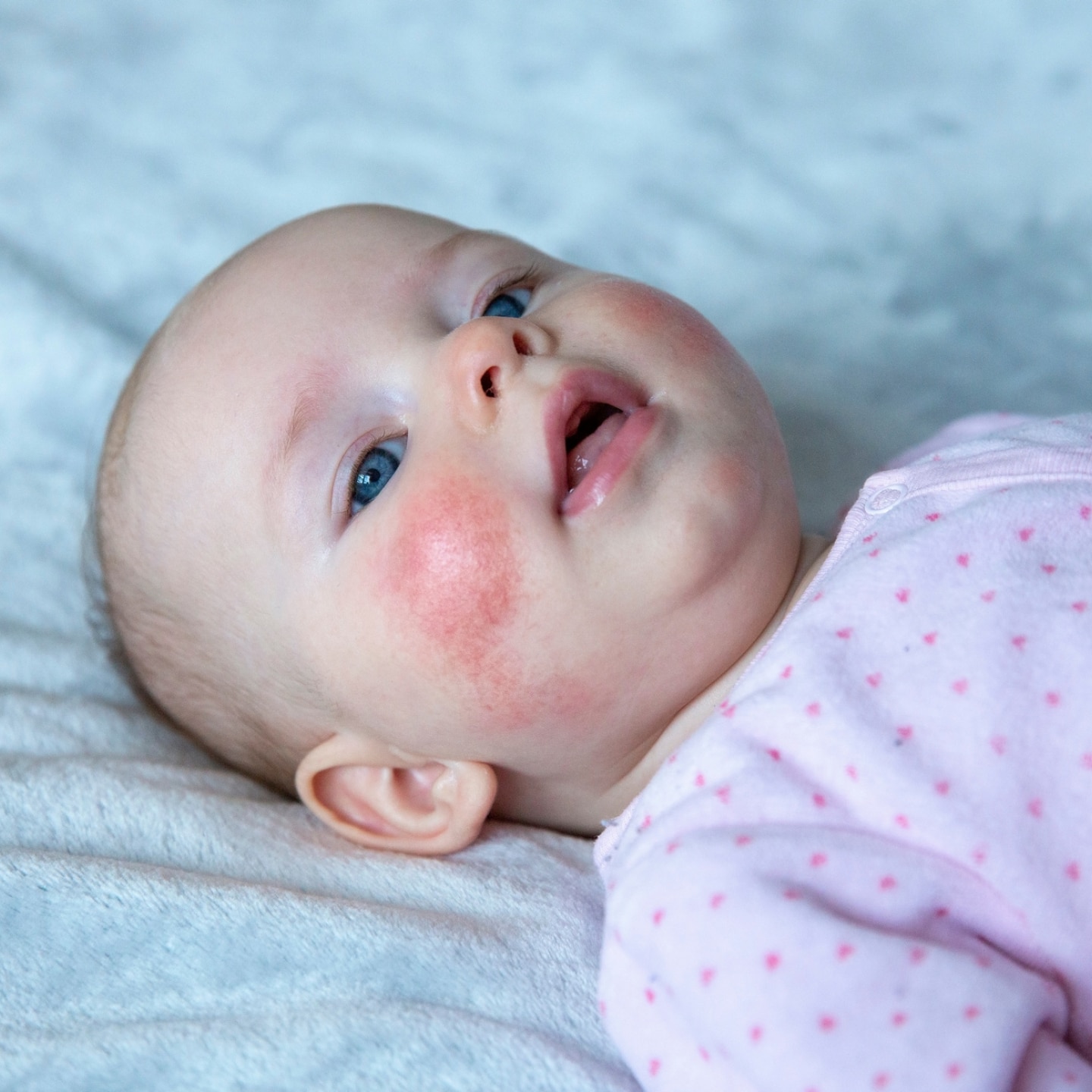 baby-mit-roten-wangen