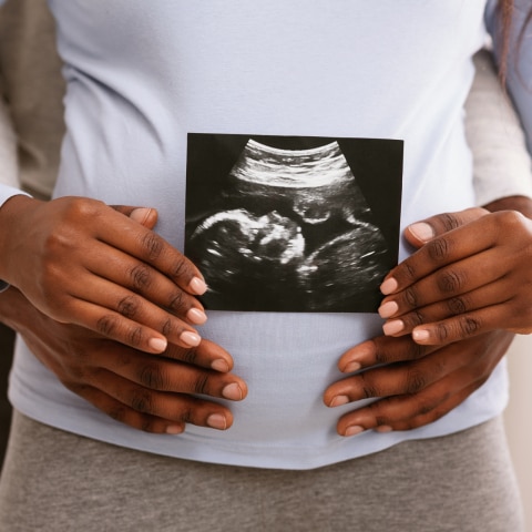 schwangere-hält-ultraschall-bild-vor-ihren-bauch