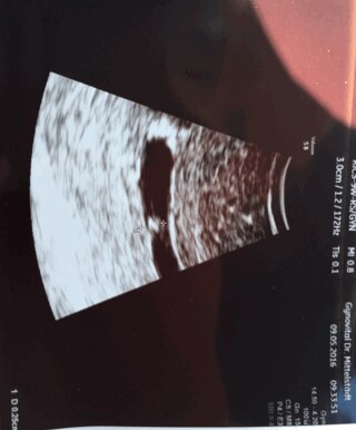 Bild zu Fruchthöhle - Schwanger - wer noch? Rund um die Schwangerschaft