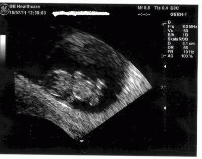 Bild zu Fototest...mal sehen ob ich das hinbekomme :0) - Forum für Februar - Mamis