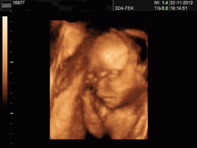 Bild zu VU und 3D Bildchen - Forum für März - Mamis