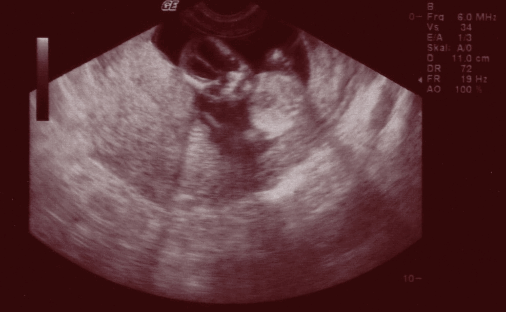 Bild zu Das Alien in meinem Bauch :-) - Forum für September - Mamis