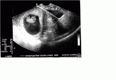Bild zu Bild vom Krümel :-) - Forum für November - Mamis