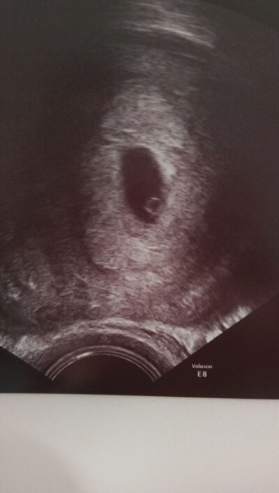 Bild zu Tada...erstes Foto vom Krümmelmonster - Forum für November - Mamis