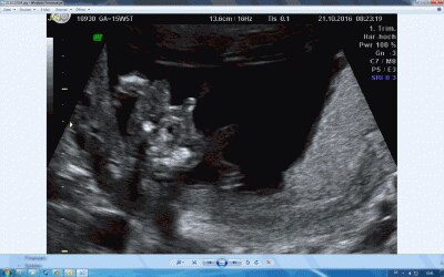 Bild zu Jungsouting zuverlässig? - Baby Forum - Allgemeine Themen